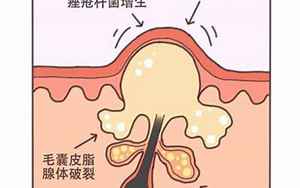 为什么手比脸白那么多