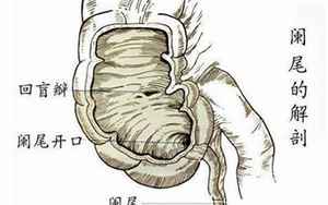 怎么判断是不是阑尾炎(如何判断阑尾炎)