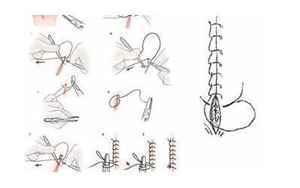 八字缝合方法(关于医械系列)