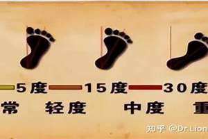 女人外八字走路是什么意思(女人外八字走路的风水)