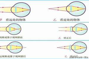 八字看近视眼(八字看近视)