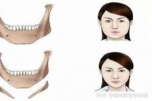 下颌角突出面相说法(下颌角突出面相)