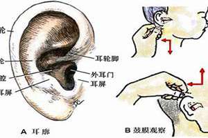 耳轮凹进去面相学(耳轮内凹面相)