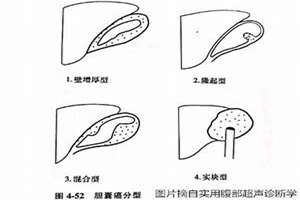 胆囊癌晚期人生群(胆囊癌晚期面相)